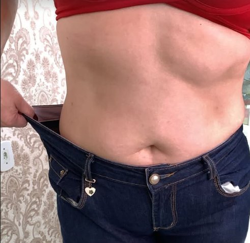 Paciente mostrando a calça jeans que ficou larga